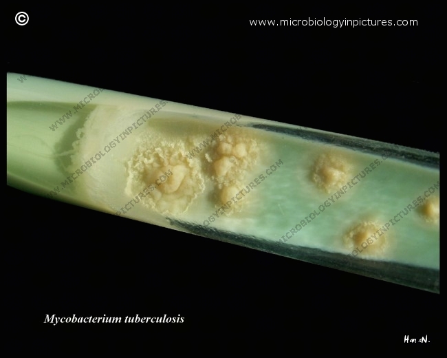 L�wenstein-Jensen medium in a tube